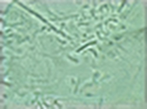 Traitement des maladies parodontales Bacteries 1