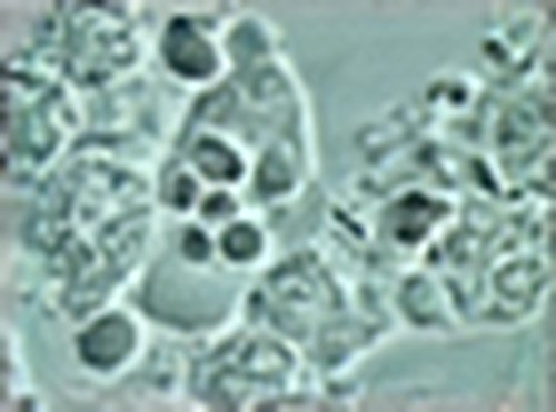 Traitement des maladies parodontales Bacteries 2