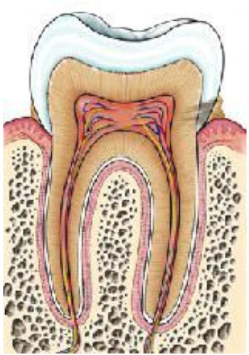 caries dentaires 1
