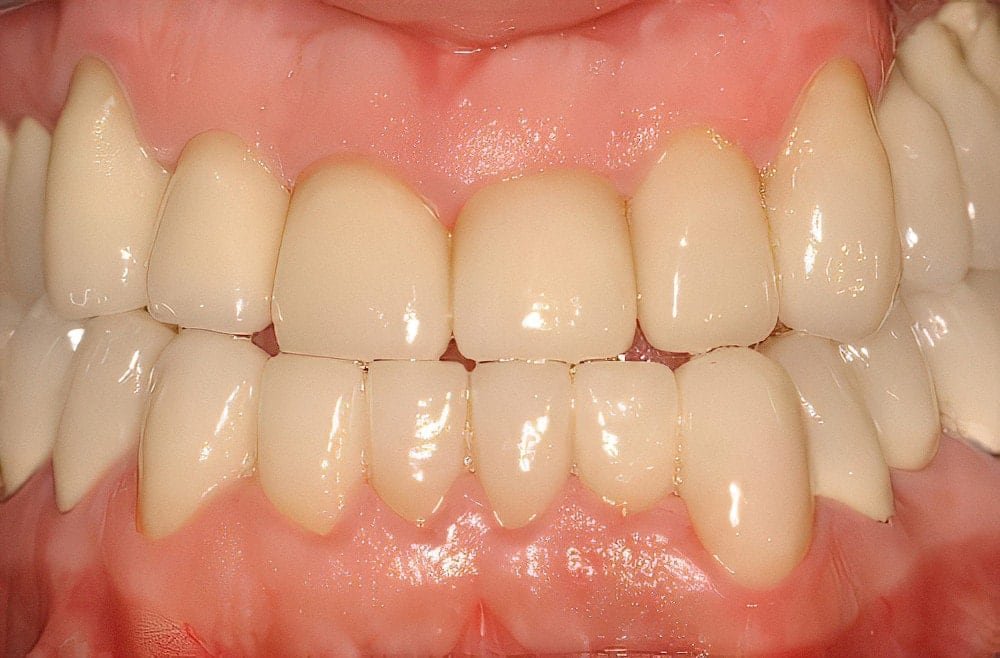 Retrouver un beau sourire Strasbourg Correction articule