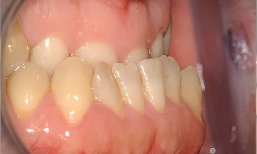 Retrouver un beau sourire Strasbourg Correction articule