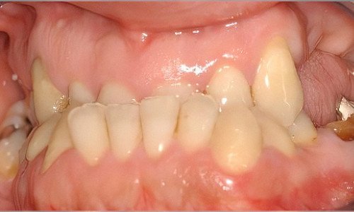 Retrouver un beau sourire Strasbourg Correction-articule