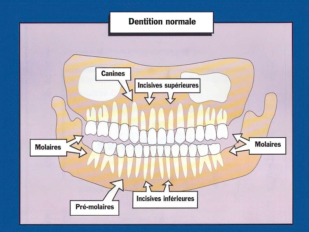implants dentaires Strasbourg