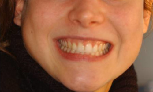 Informations patients La bouche