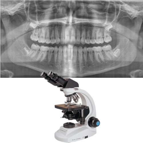 Traitement Maladie Parodontale Strasbourg