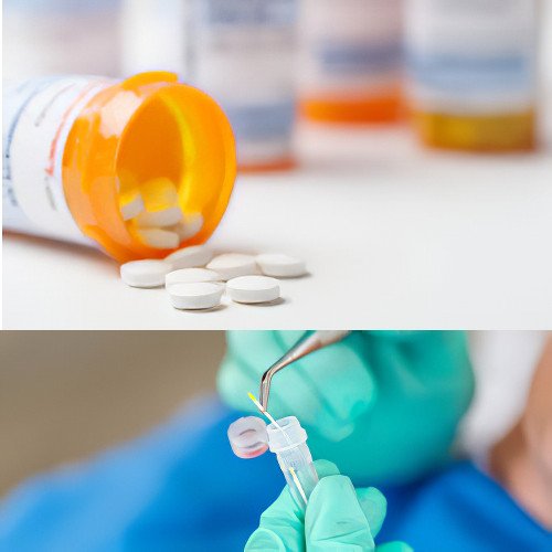 Traitement Maladie Parodontale Strasbourg